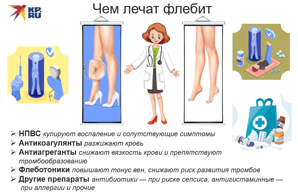 Чем лечат флебит