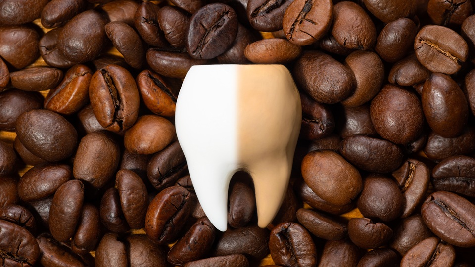 Черный налет на зубах у взрослых