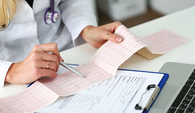 Определить перикардит поможет ЭКГ. Фото: Shutterstock