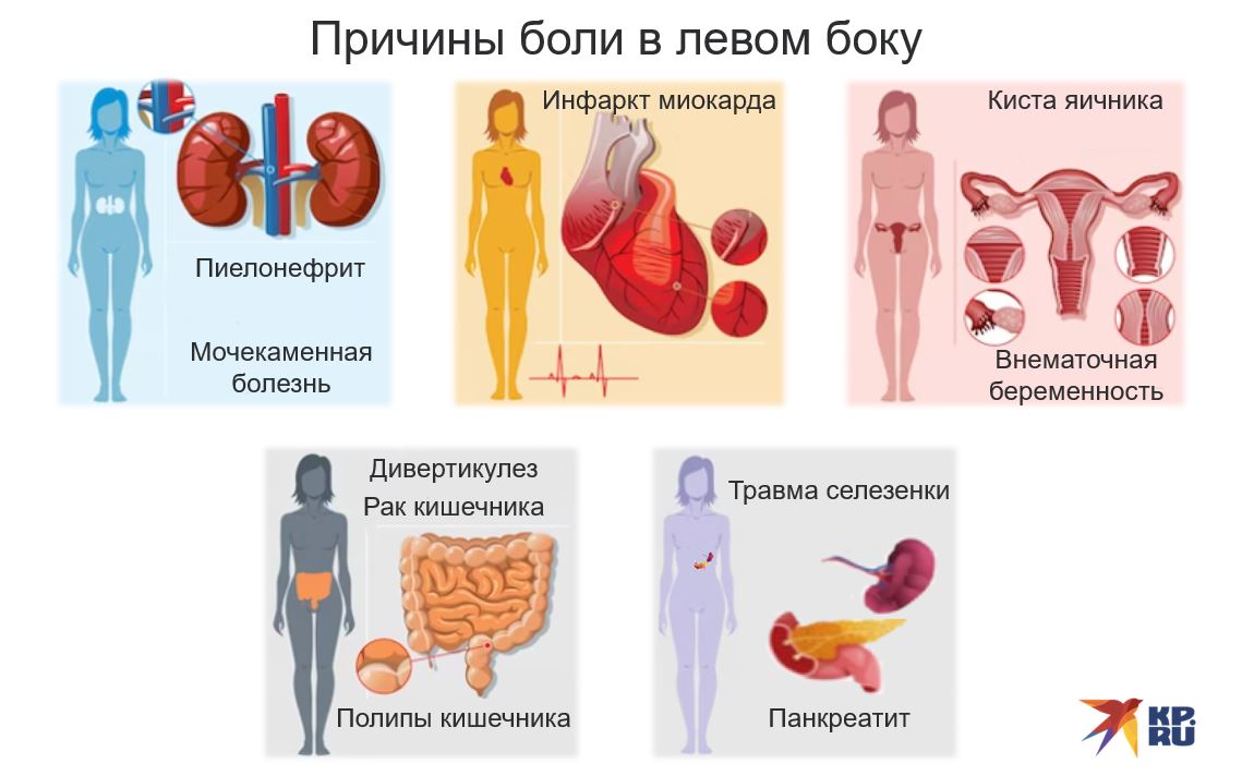 Причины боли в левом боку