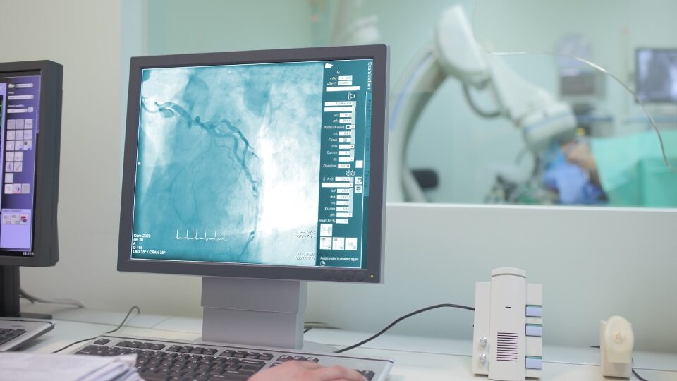 Коронарография сосудов сердца