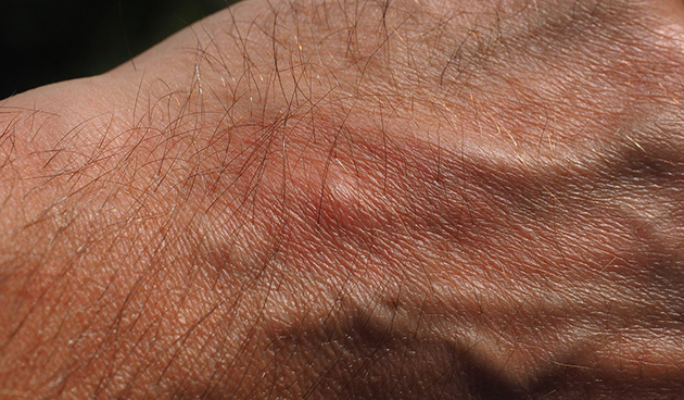 Осы на даче