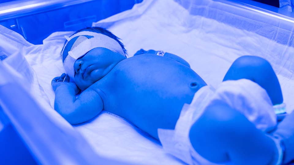 5 лучших ламп от желтушки новорожденных в 2025 году